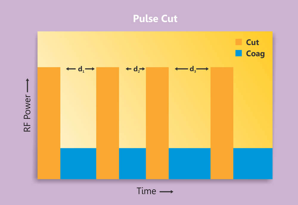 Smart Pulse Cut